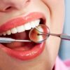 Caries Dental: Causas, Prevención y Tratamiento