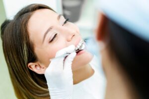 ¿Qué es la Limpieza Dental? Beneficios y Recomendaciones Clave